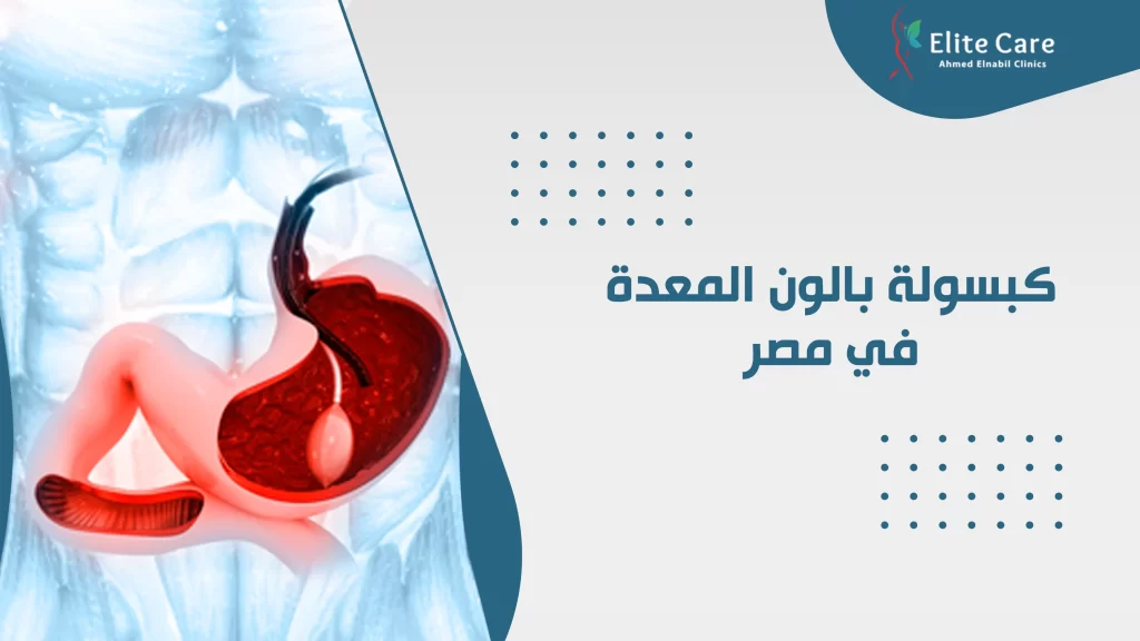 كبسولة بالون المعدة فى مصر
