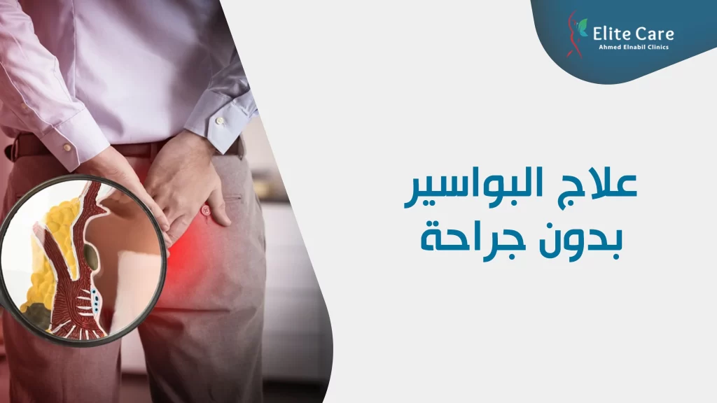 علاح البواسير بدون جراحة