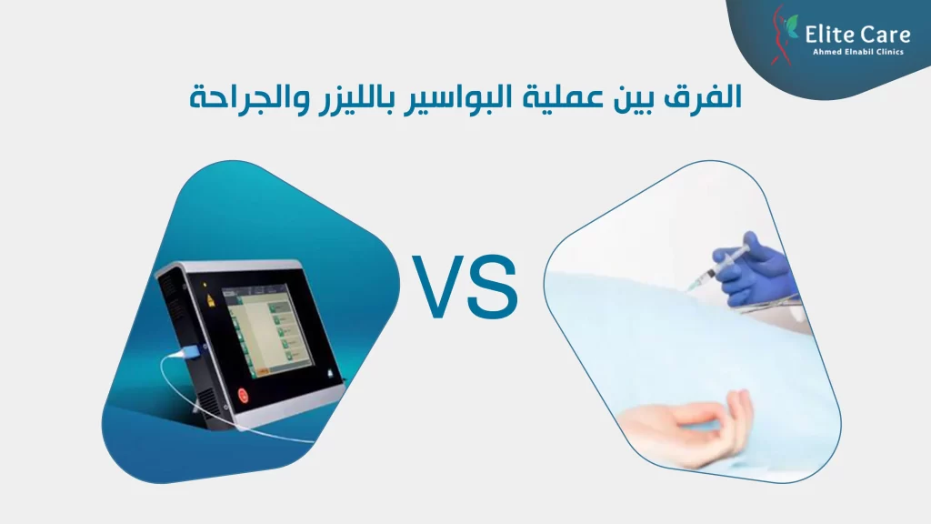 الفرق بين عملية البواسير بالليزر والجراحة