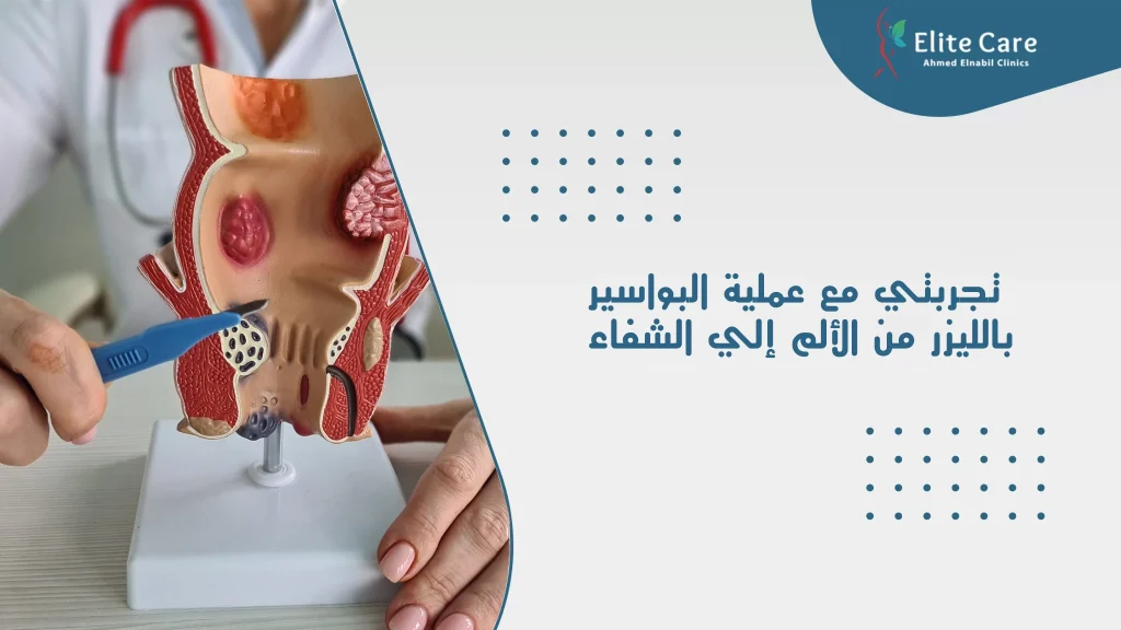 تجربتي مع عملية البواسير بالليزر من الألم إلي الشفاء