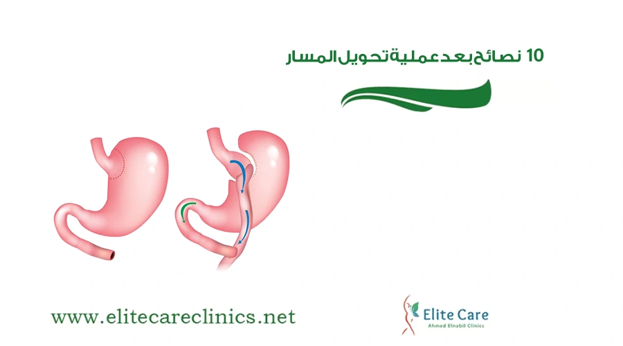 10 نصائح بعد عملية تحويل المسار