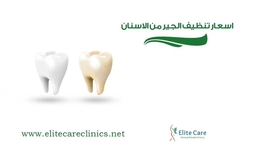 اسعار تنظيف الجير من الاسنان​​