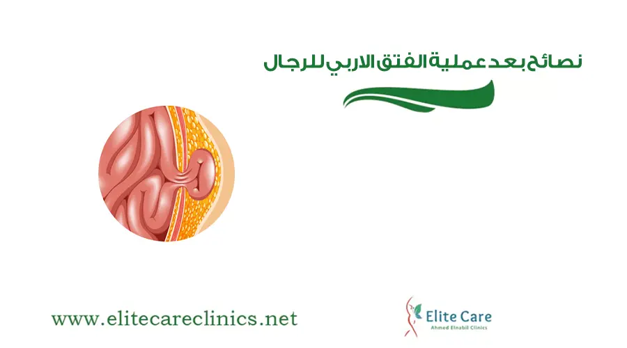 نصائح بعد عملية الفتق الاربي للرجال